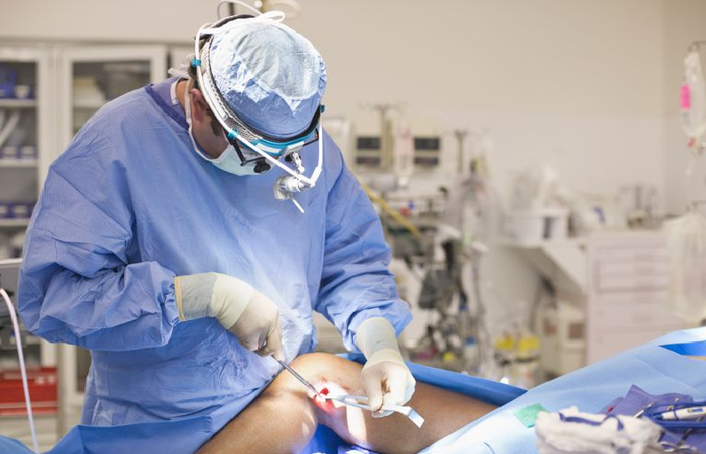 choose a surgeon if you are opting for a knee surgery
