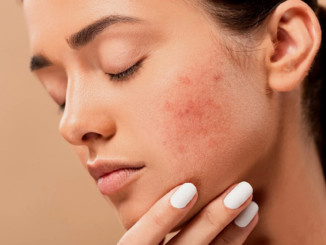 Common Types Of Skin Problems And How To Detect Them