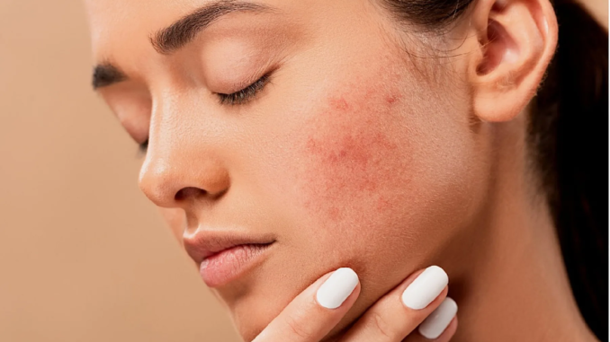 Common Types Of Skin Problems And How To Detect Them